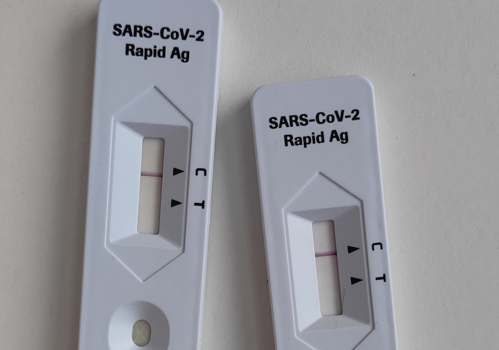 Proba autodiagnostikoan positibo emanez gero, inprimaki bat betetzea eskatu du Osakidetzak