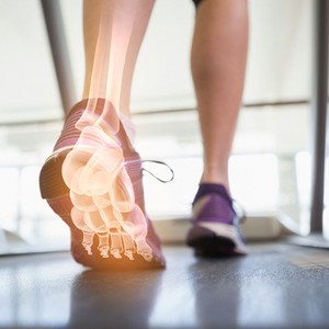 Kirolarien podologia