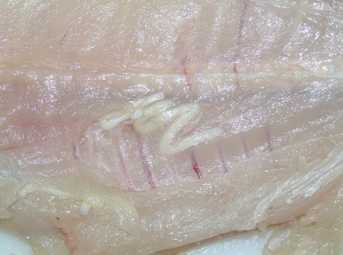 Anisakisa, arrainen parasitoa