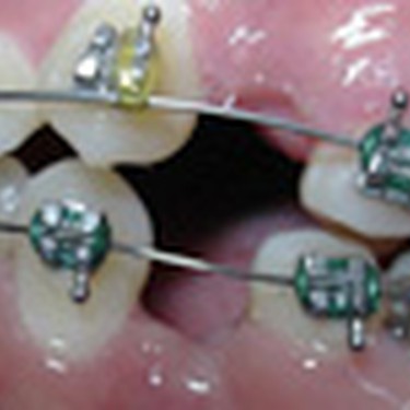 Ortodontziak