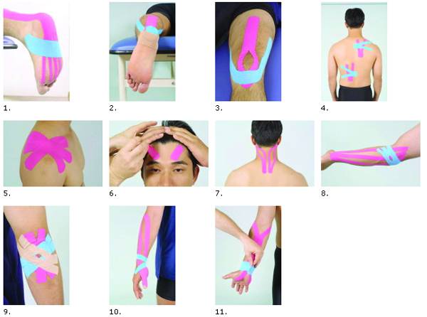 Hesgailu funtzionala eta Kinesio Tape